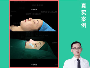案例3